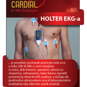 Holter EKG-a